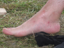 RHF-2007 Treffen