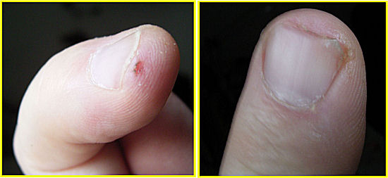 finger.jpg